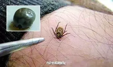 男子釣魚(yú)感覺(jué)手腕有小蟲(chóng) 拍死后瞬間雙手起皰潰爛