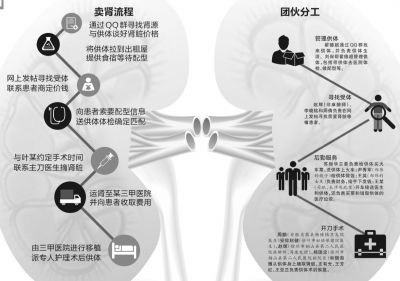 販腎51枚涉案超千萬(wàn)15人獲刑